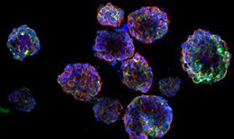 首個鼻咽癌3D類器官模型!用于精確的治療輻射劑